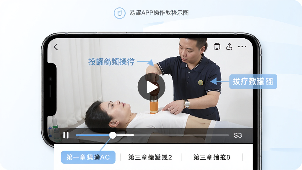 易罐APP操作教程示意图,一部手机展示易罐的罐疗视频教程播放界面,屏幕上有讲师演示拔罐操作,界面下方有进度条与章节列表,背景为简洁的白色与浅蓝色,风格专业清晰,细节上突出视频播放按钮与操作步骤标注,画质高清,干净无多余元素。