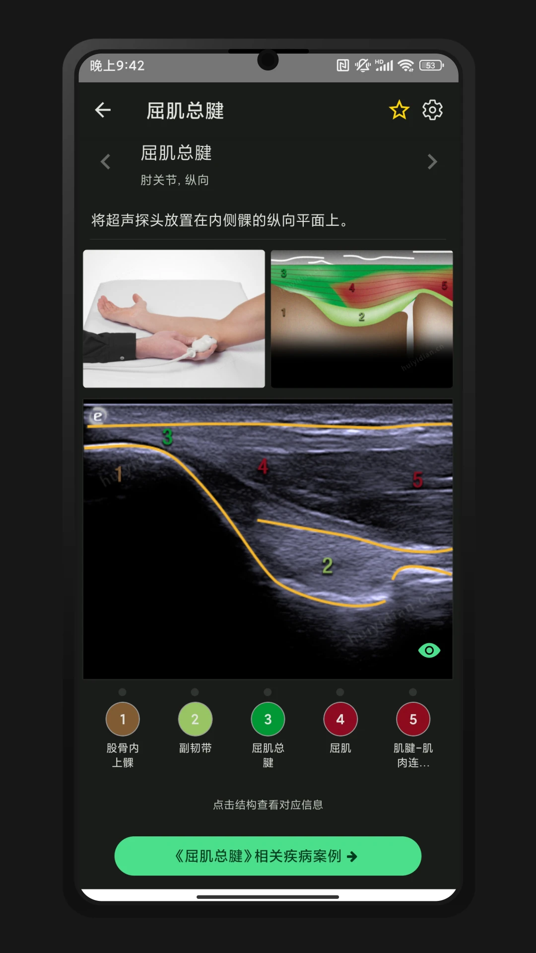 超声智学2.2.0 医学影像学习