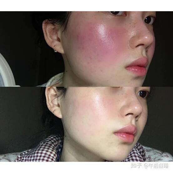 遇颜护肤敏感肌使用前后对比测评