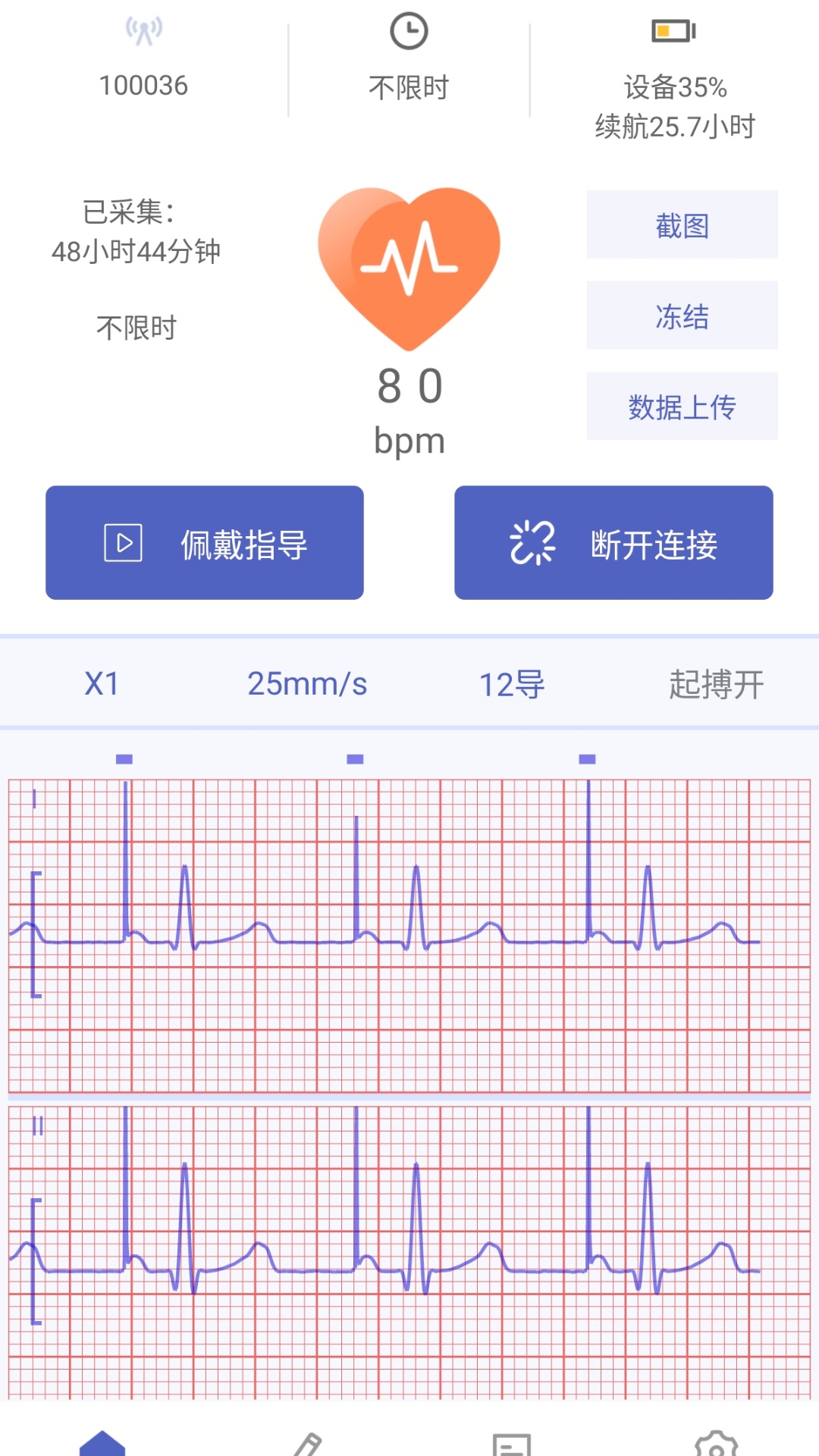 ��ӰС�ǽ���2.1.3 ������������
