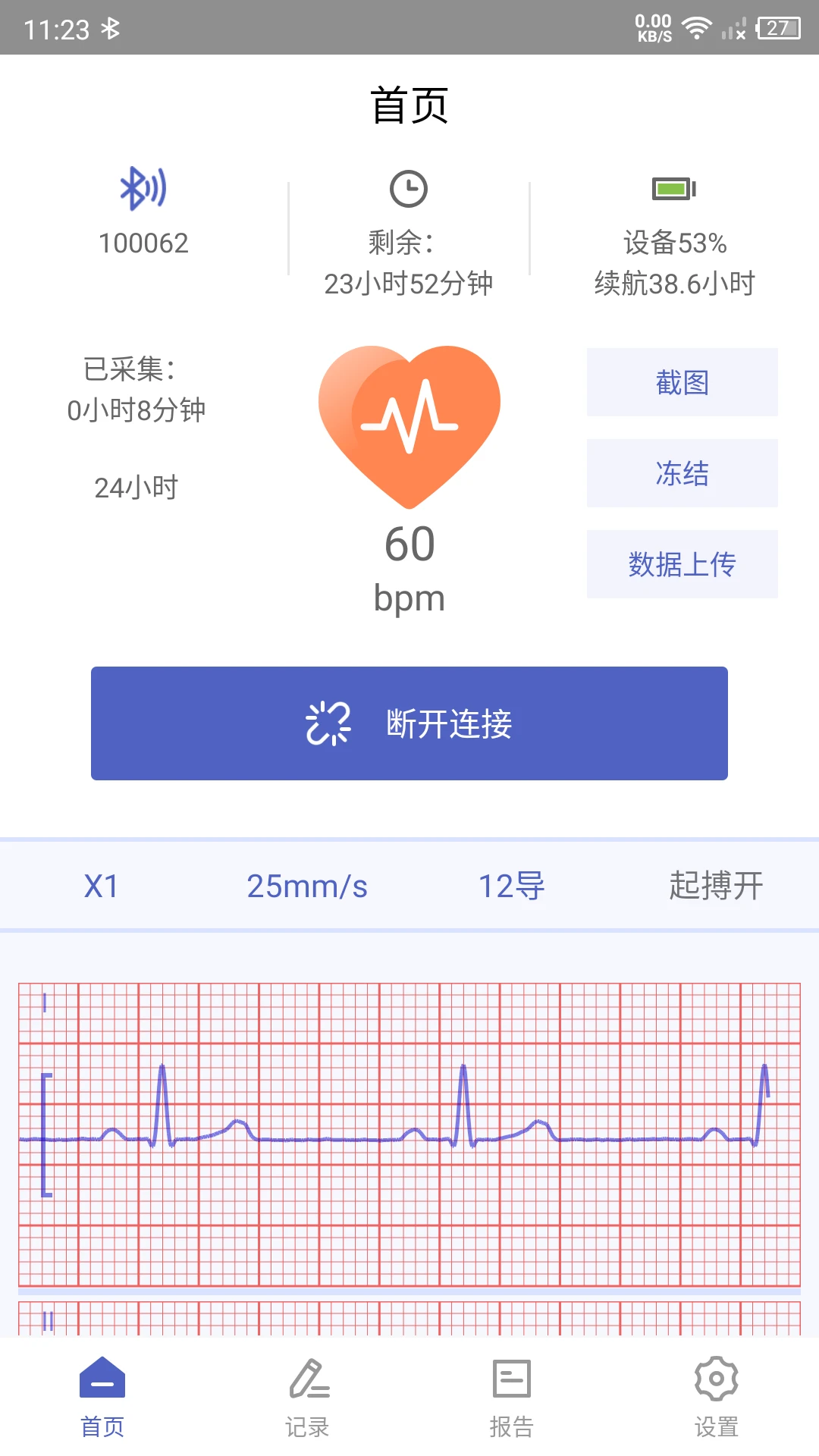 ��ӰС�ǽ���2.1.3 ������������