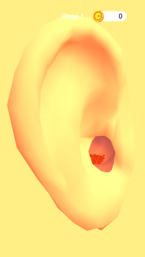 Earwax Clinic游戏安卓中文版 Earwax Clinic游戏安卓中文版