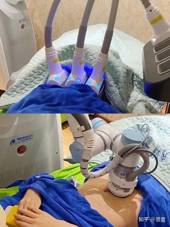 瘦疗仪器操作过程实拍图