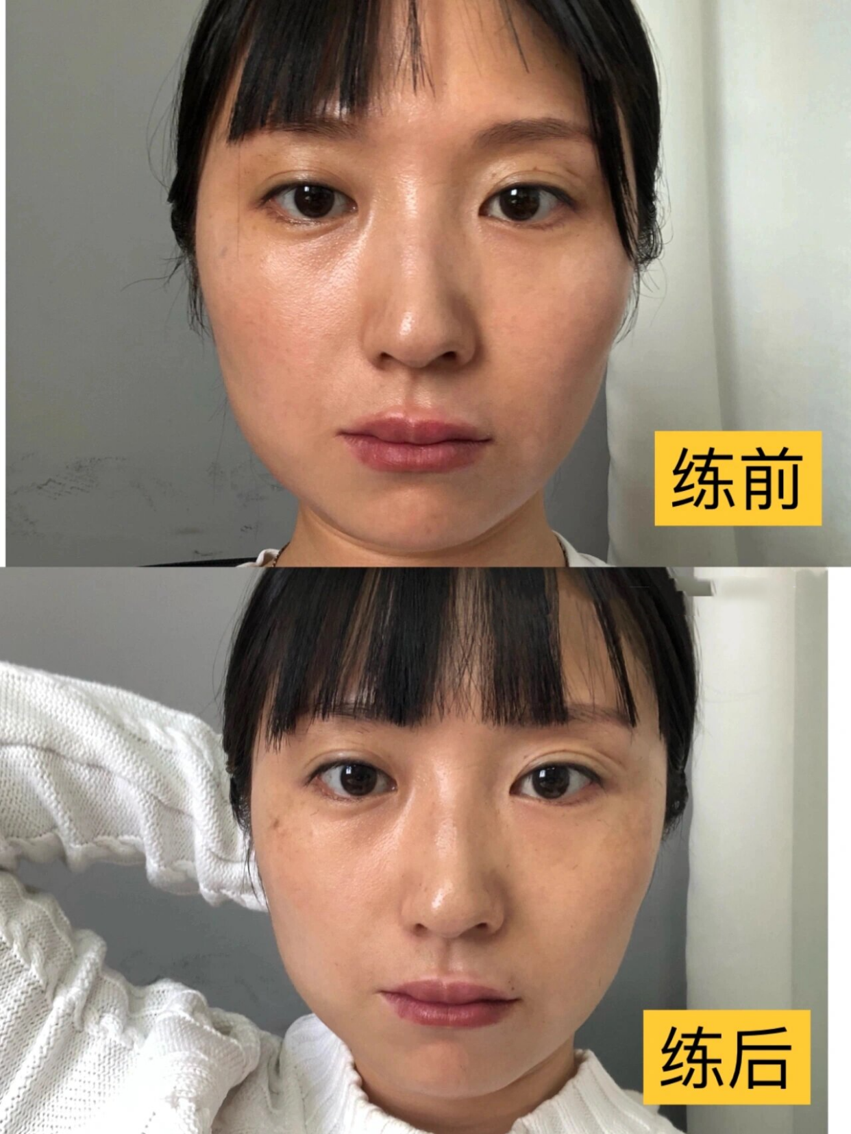 Yolight面部瑜伽瘦脸亲测全过程真实效果对比图