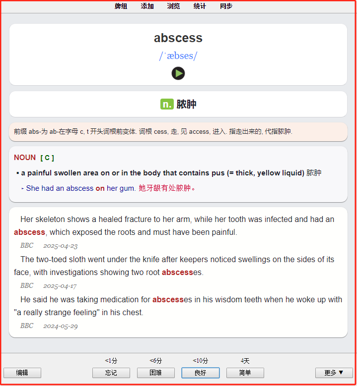 ҽѧӢ�ﱳ������Ƭʱ����䷨ Anki��Ƭ ҽѧӢ��App �ٴ������ʻ� ��Ч���似��